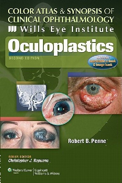 COLOR ATLAS & SYNOPSIS OF CLINICAL OPHTHALMOLOGY OCULOPLASTICS
