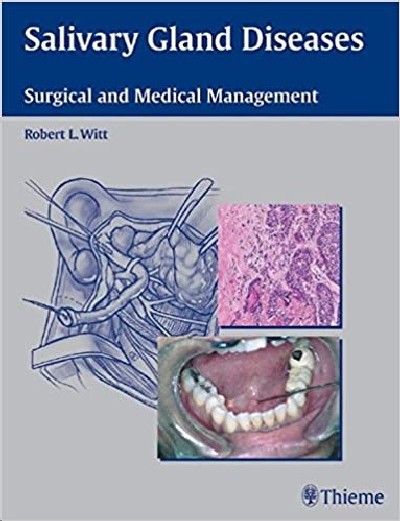 SALIVARY GLAND DISEASES